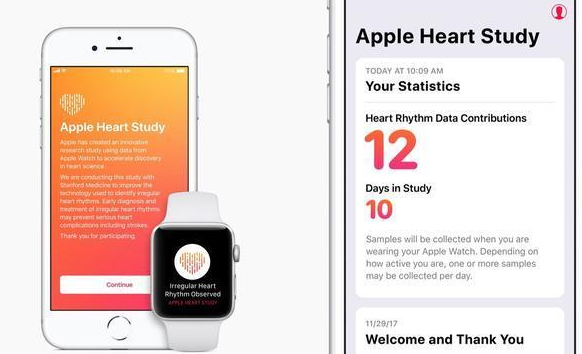 美国探索用苹果智能手表传感器研究心脏病