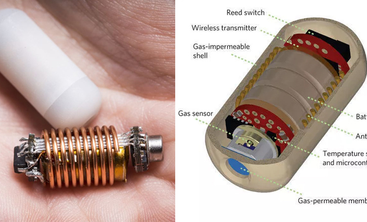 国外开发出吞咽式电子胶囊：含多种传感器可测肠道内气体