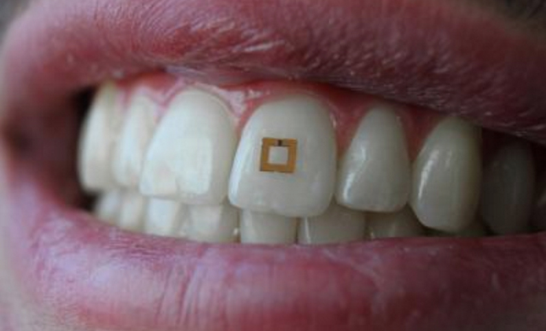 美国科学家开发了一款可贴在牙齿上的<font color=red>微型传感器</font>